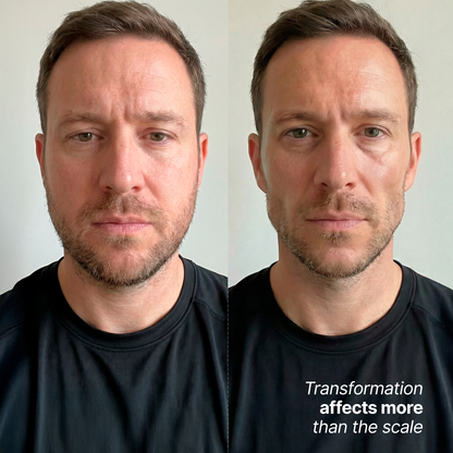 Support Facial Fullness During Weight Loss